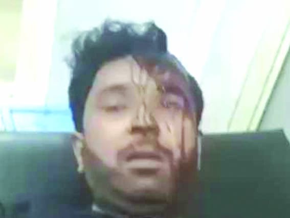 हरिद्वार: यूपी के यात्रियों को बुरी तरह पीट कर किया गंभीर रूप से घायल, मुकदमा दर्ज